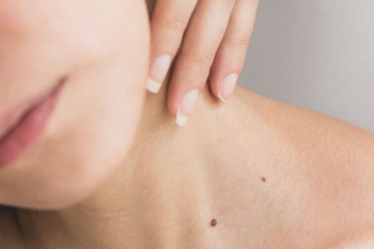 ICONIQUE SKIN Erfahrungen: Wie die Endospheres-Therapie Haut und Figur transformiert